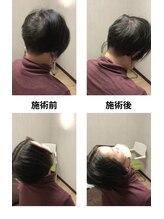 トリデ 合志店(TORIDE)/首の可動域のビフォーアフター