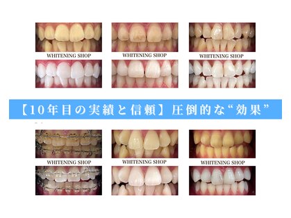 ホワイトニングショップ 茨木店の写真