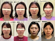 整音(totonone)の雰囲気（小顔矯正/口ゴボ/Eライン/リンパ/二重アゴ/エラ/左右差/ハチ張り）