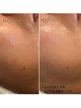 ディア(DIA)/【毛穴ケア・ザラつき解消】