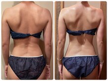 ビューティースタイリング 自由が丘店(beauty styling)/《頑固なコリともおさらば！》