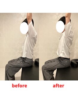 ナオル整体 福岡香椎院(NAORU整体)/30代男性施術事例【猫背】