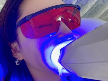 ミルクホワイトニング 久留米店(Milkホワイトニング)の写真/『都度払いOKなホワイトニングサロン』お手軽価格◎効果重視で満足度◎まずはお試しから♪