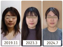 あんじゅみにょん80の雰囲気（その時々、状態に合わせて長期的にサポートさせていただきます。）