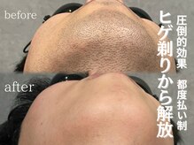 イーラディン(E-RADIN)
