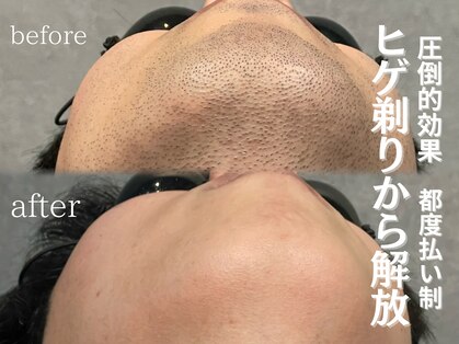 イーラディン(E-RADIN)の写真
