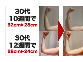 ボディアーキ 中野店(BODY ARCHI)/腕がほっそり　夏に向けて