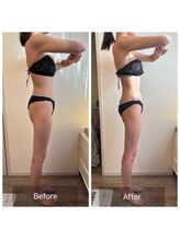 エヌア(nA)/2ヶ月プラン♪20代痩身全身！