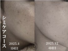 アールエーサロン 恵比寿 広尾(Ra salon)