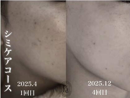 アールエーサロン 恵比寿 広尾(Ra salon)の写真