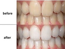 メルヴェイユ/東中野ホワイトニング