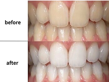 メルヴェイユ/東中野ホワイトニング