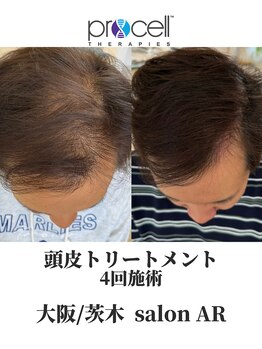 サロン アール(salon AR)/プロセルセラピーズ
