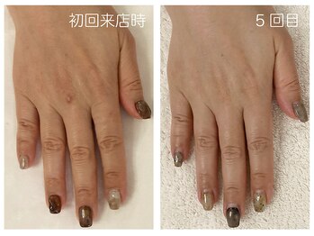 キレイテ 上野店/40代/5回目【ハンドケア稲荷町】