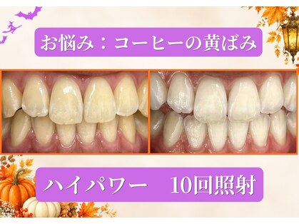 LBSホワイトニング 渋谷店の写真