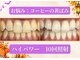 LBSホワイトニング 渋谷店の写真