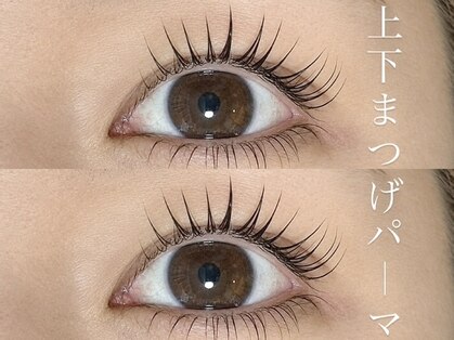 ナップ(Napp)の写真