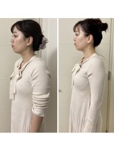ソウ バイ ソウ(So by 蒼)/小顔矯正で、重い首肩こり解消！