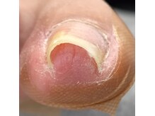 001 新横浜/両側も一回で矯正できます