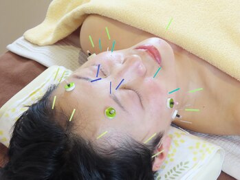 晴レヤカ鍼灸治療院