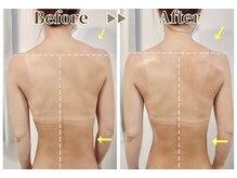 セッテベレッザ(Sette Bellezza)の雰囲気（オールハンド施術で痩身だけでなく左右差・ゆがみ改善/姿勢改善!）
