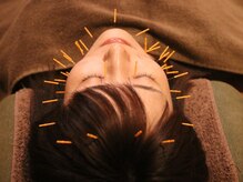 しろくま鍼灸院/しろくまFIT