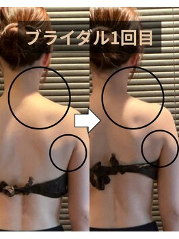 ミーツ(MEETS)/ブライダル1回目