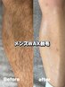 メンズWAX脱毛【両膝下・両膝上】