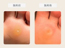 ルポ 伊勢/タコケア