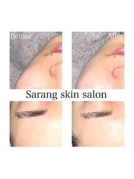 Sarang skin salon/川西｜肌管理サロン