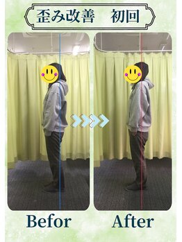 アミーゴ整体院/ビフォーアフター