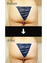 カナエル(QANAEL)/スリミングクリーム効果2