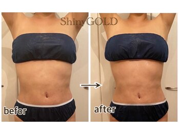 シャイニーゴールド 新所沢店(Shiny GOLD)/1回でも驚きの引き締め効果◎