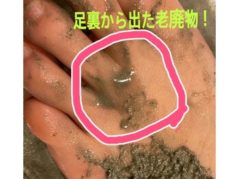 アルコイリス(Arco iris)/足裏にこれだけ溜まっています