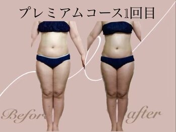 ヨサパーク ピュアン(YOSA PARK)/プレミアムコース1回目