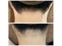 ミース 市川店の雰囲気（【ビフォーアフター】綺麗なうなじでアップヘアに自信♪）