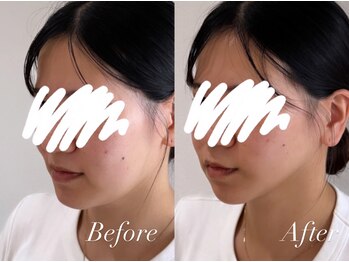 ハクト(Hakuto)/Before/After