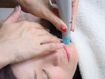 おうか鍼灸整骨院の写真/【毛穴黒ずみ洗浄】ハリツヤの持続力◎大人女性が目指す美肌を作る♪黒ずみや角栓を洗浄しニキビケアにも！