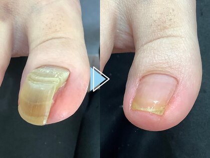 ネイルメディックス 宇都宮店の写真