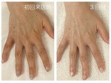 キレイテ 上野店/50代/3回目【ハンドケア稲荷町】