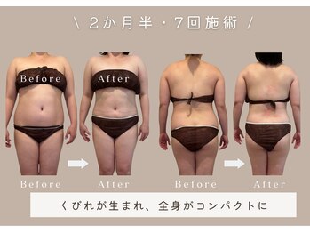 マリーズウィル(MARY's WILL)の写真/【痩せにくい方必見】ボディラインが崩れる原因は、体重だけでなく〈歪み・冷え・巡りの滞り〉かも！？