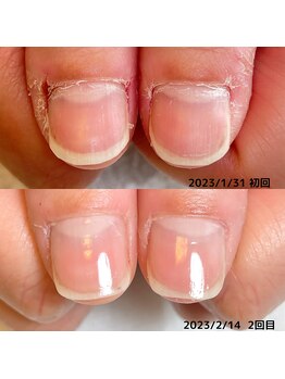 コフズ(Kofz)/美爪育成経過 2回目！