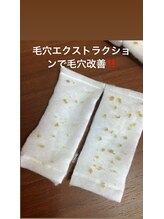 リンカ(Rinca)/毛穴の角栓とれまくり！毛穴革命