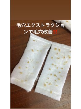 リンカ(Rinca)/毛穴の角栓とれまくり！毛穴革命