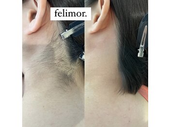 フェリモール(Felimor.)/シュガーリングbefore／after