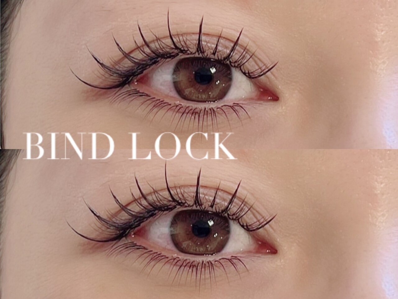 バインドロック80本