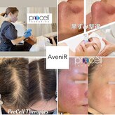 アベニール(AveniR)