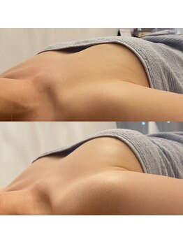 ハル 水戸市(HaRu)/バストメニューも◎