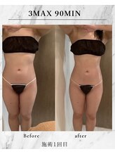 ラズリ(Lazuli)/3max 90min 施術1回