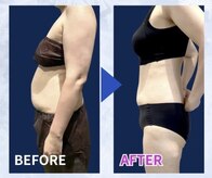 スポットスリム(SPOT SLIM)